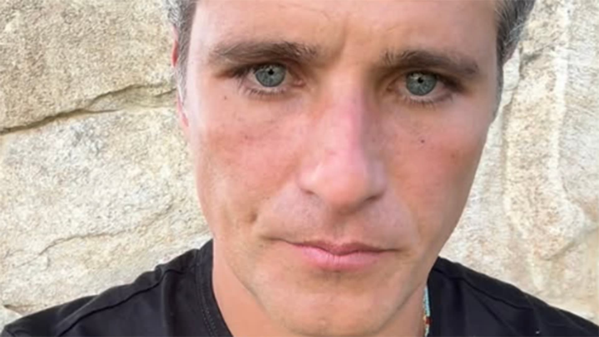 Bruno Gagliasso relata dificuldades profissionais após diagnóstico